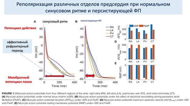 Понимание мерцательной аритмии: механизмы, триггеры и структурные изменения и Лечение