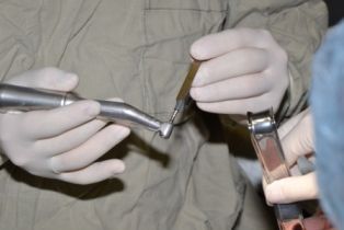 Вживляем зуб