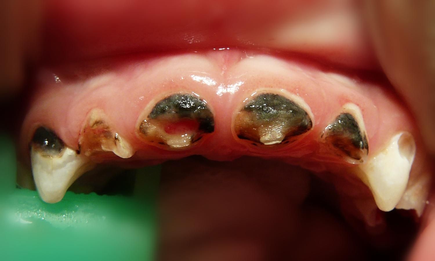 Детская стоматология ЦЭЛТ