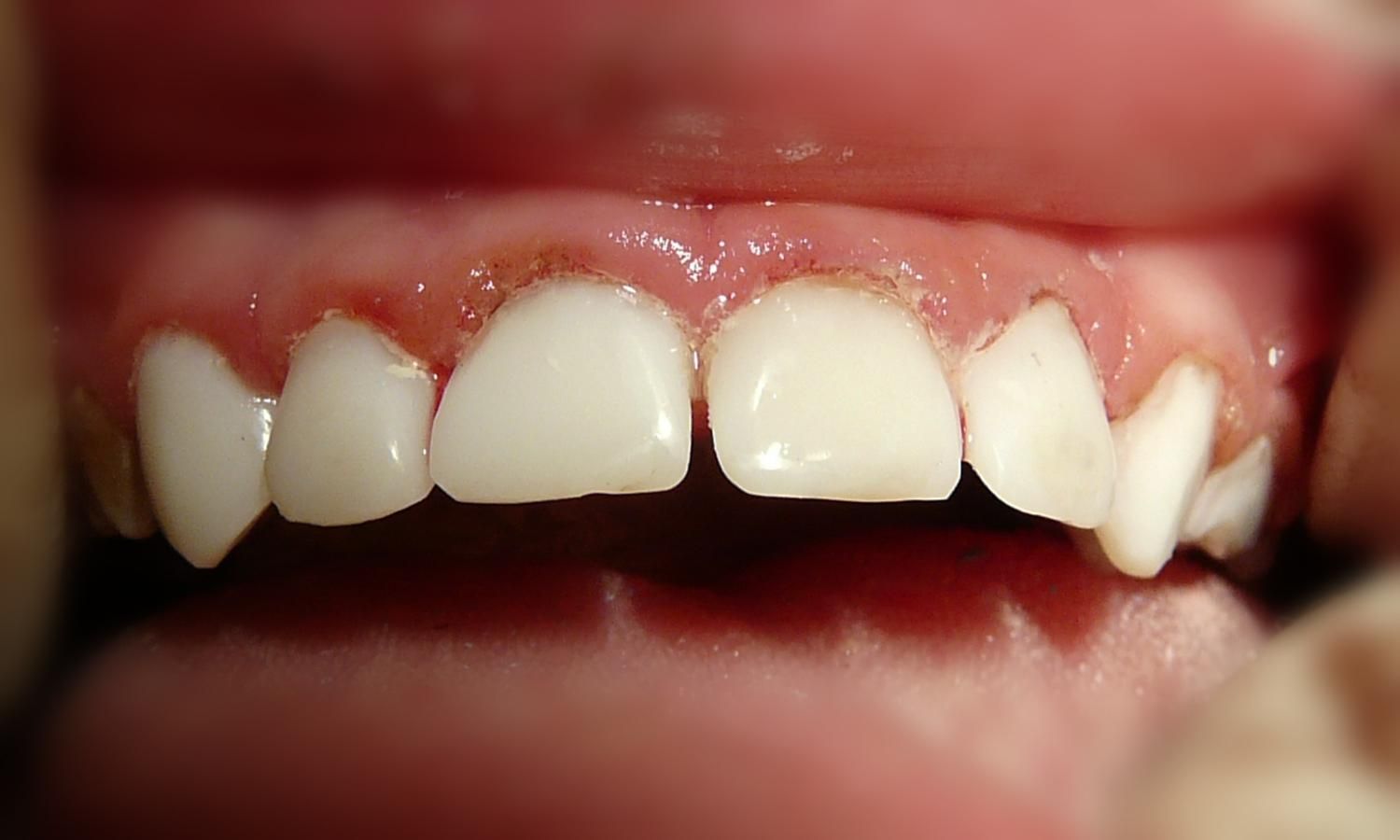 Детская стоматология ЦЭЛТ